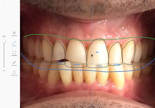 Smile Design Programm